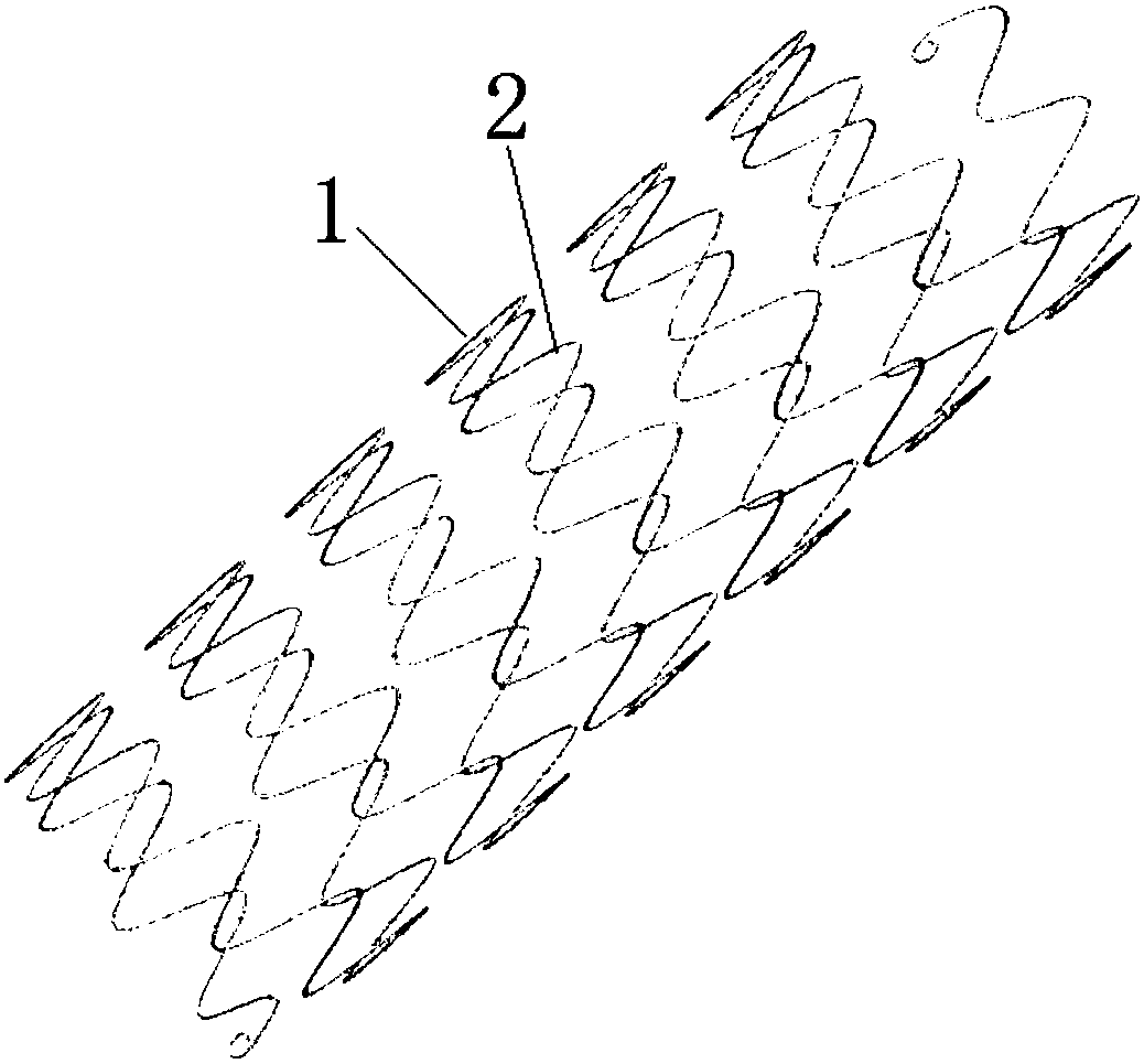 Aortic dissection vessel stent and manufacturing method thereof