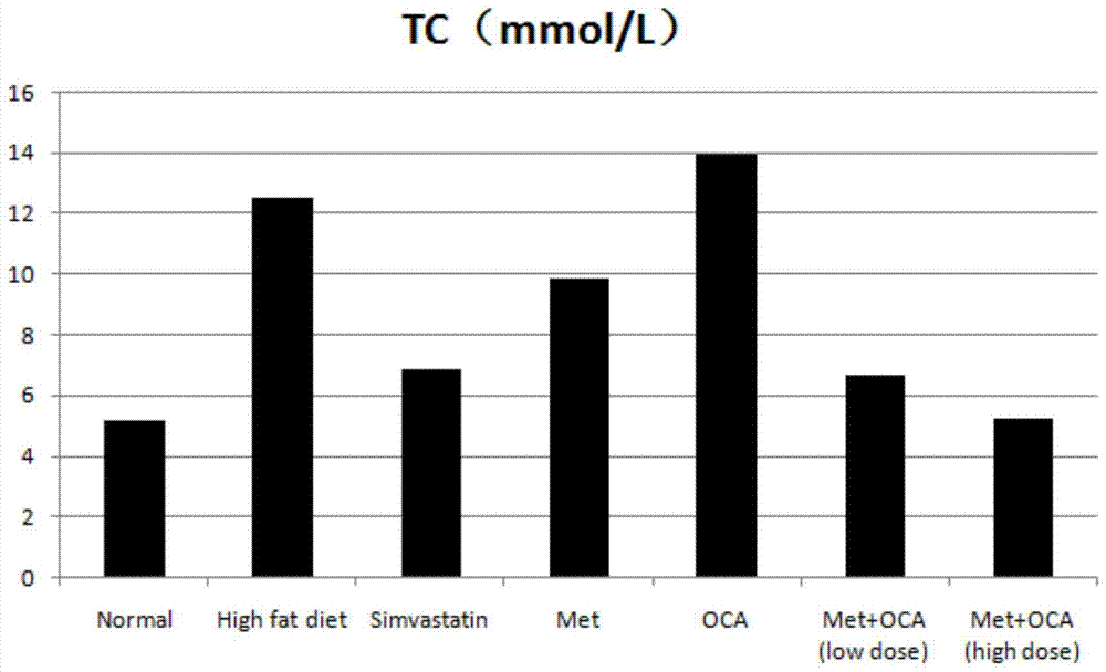 Obeticholic acid and metformin composition and application thereof