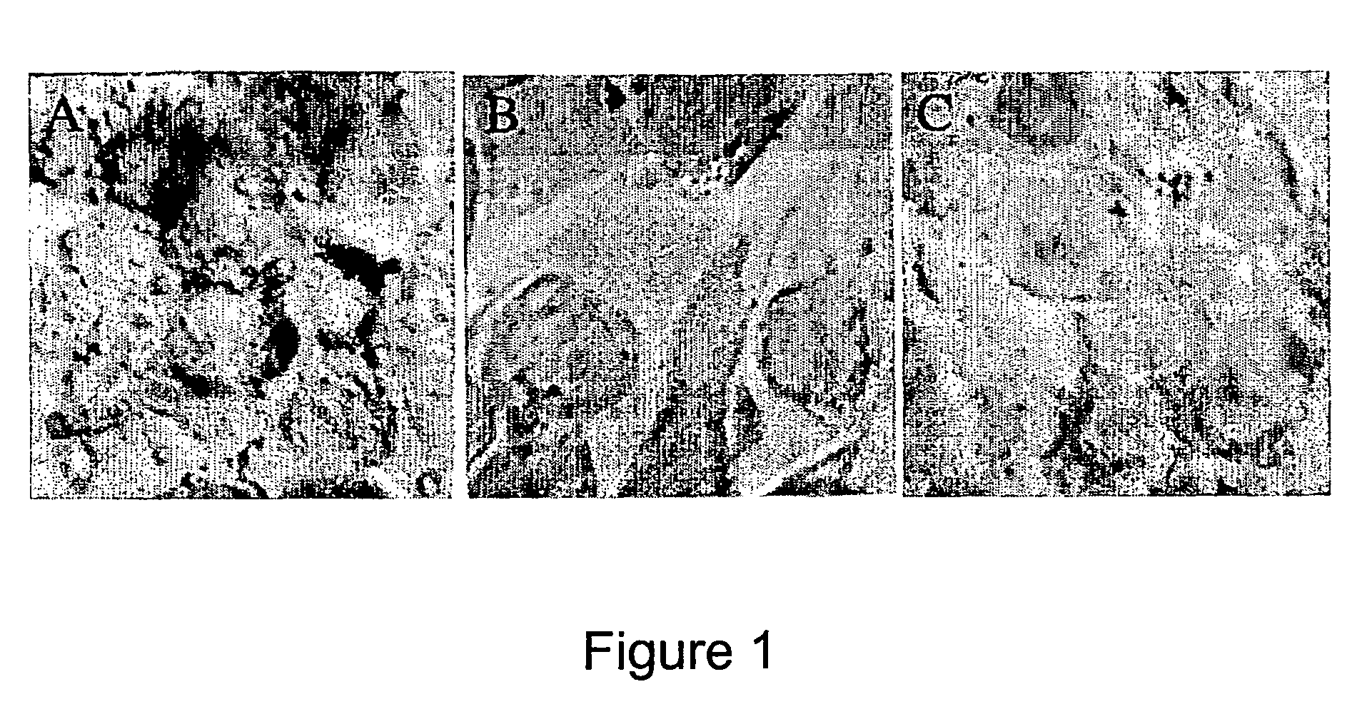 Method of inhibiting infection by hcv, other flaviviridae viruses, and any other virus that complexes to low density lipoprotein or to very low density lipoprotein in blood preventing viral entry into a cell