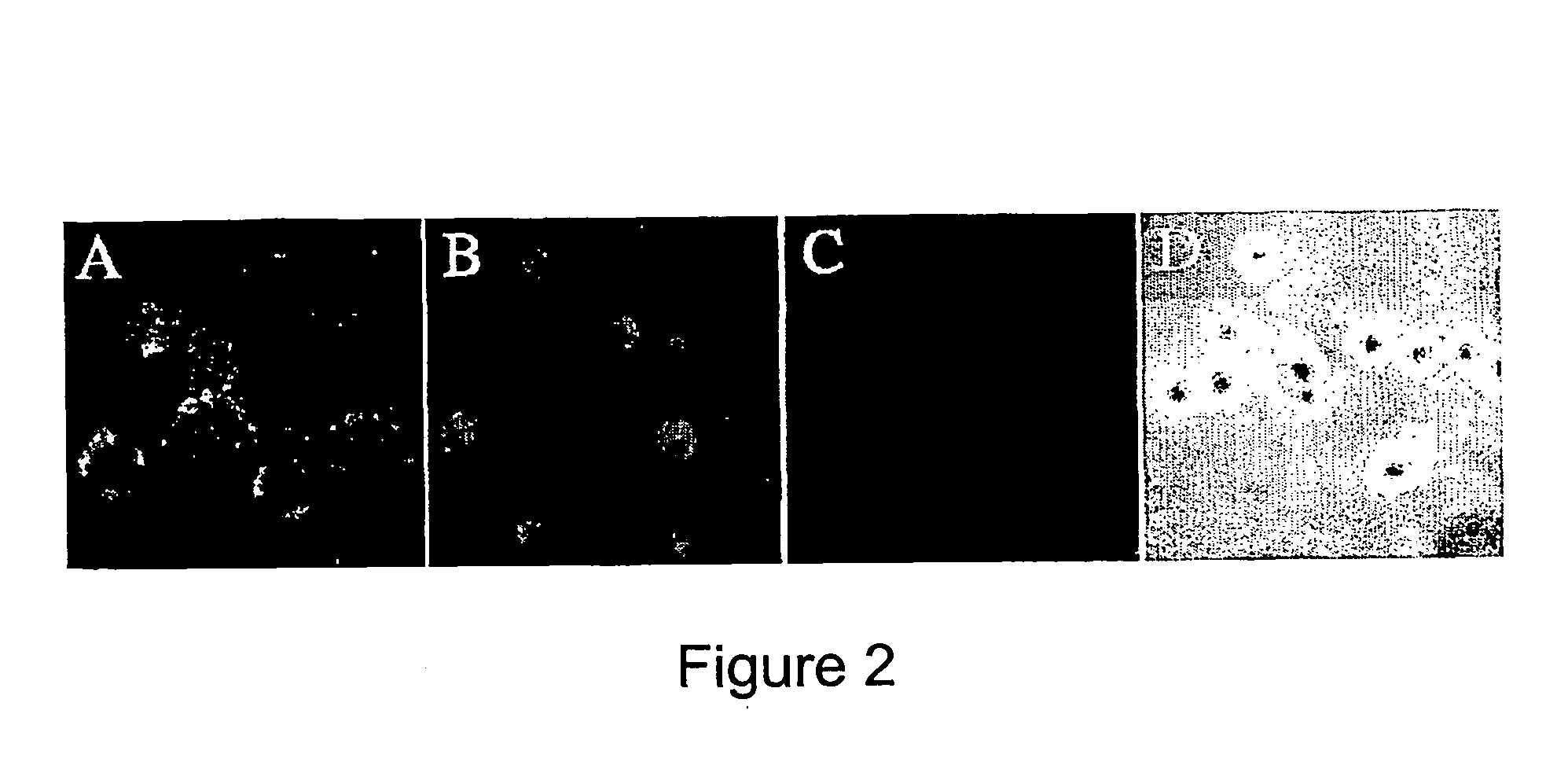 Method of inhibiting infection by hcv, other flaviviridae viruses, and any other virus that complexes to low density lipoprotein or to very low density lipoprotein in blood preventing viral entry into a cell