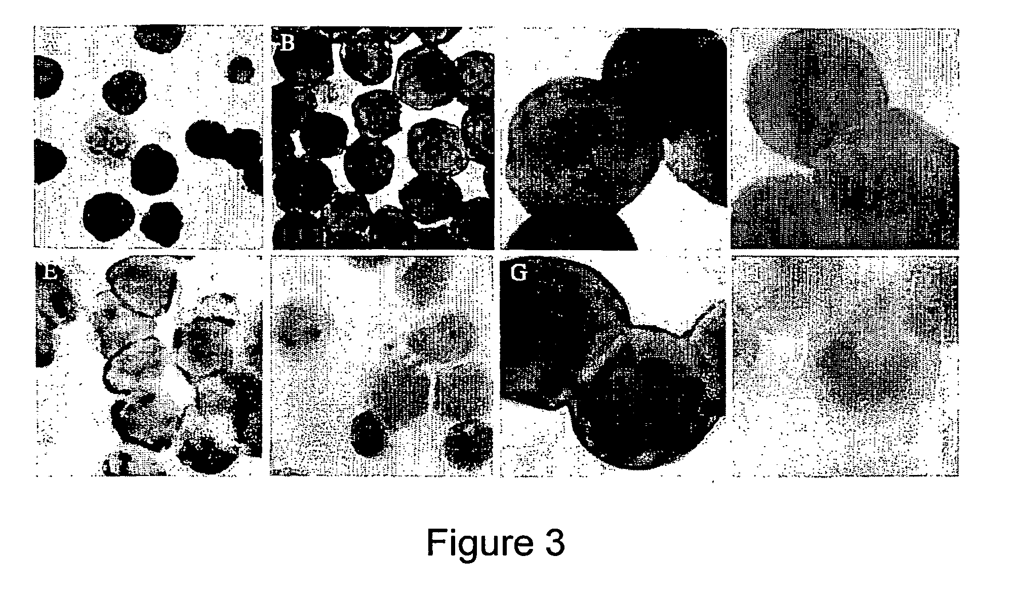 Method of inhibiting infection by hcv, other flaviviridae viruses, and any other virus that complexes to low density lipoprotein or to very low density lipoprotein in blood preventing viral entry into a cell