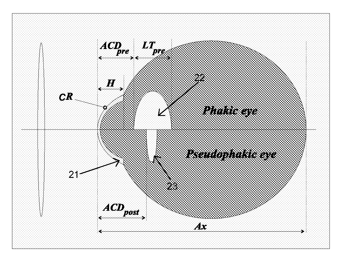 System and method for determining and predicting IOL power in situ