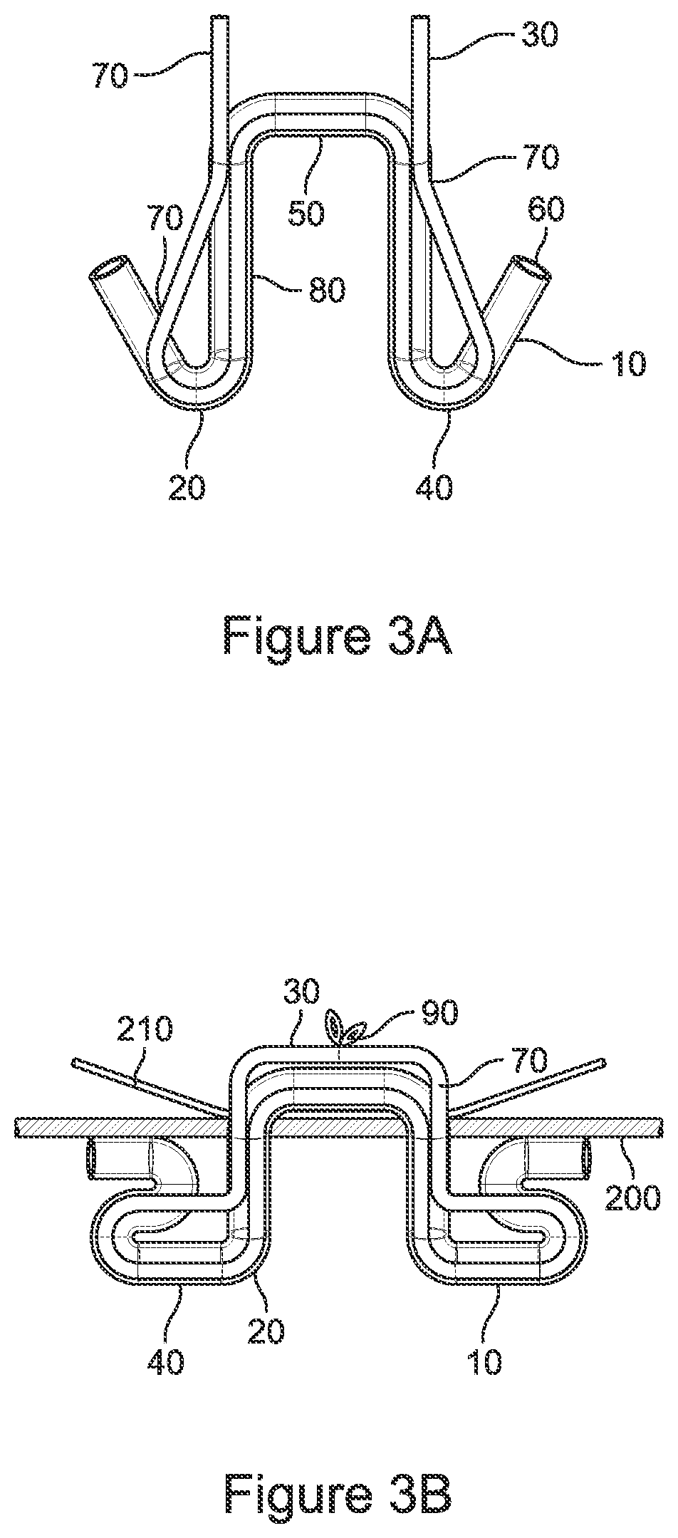 Surgical sheath, staple, and scaffold bone anchor devices