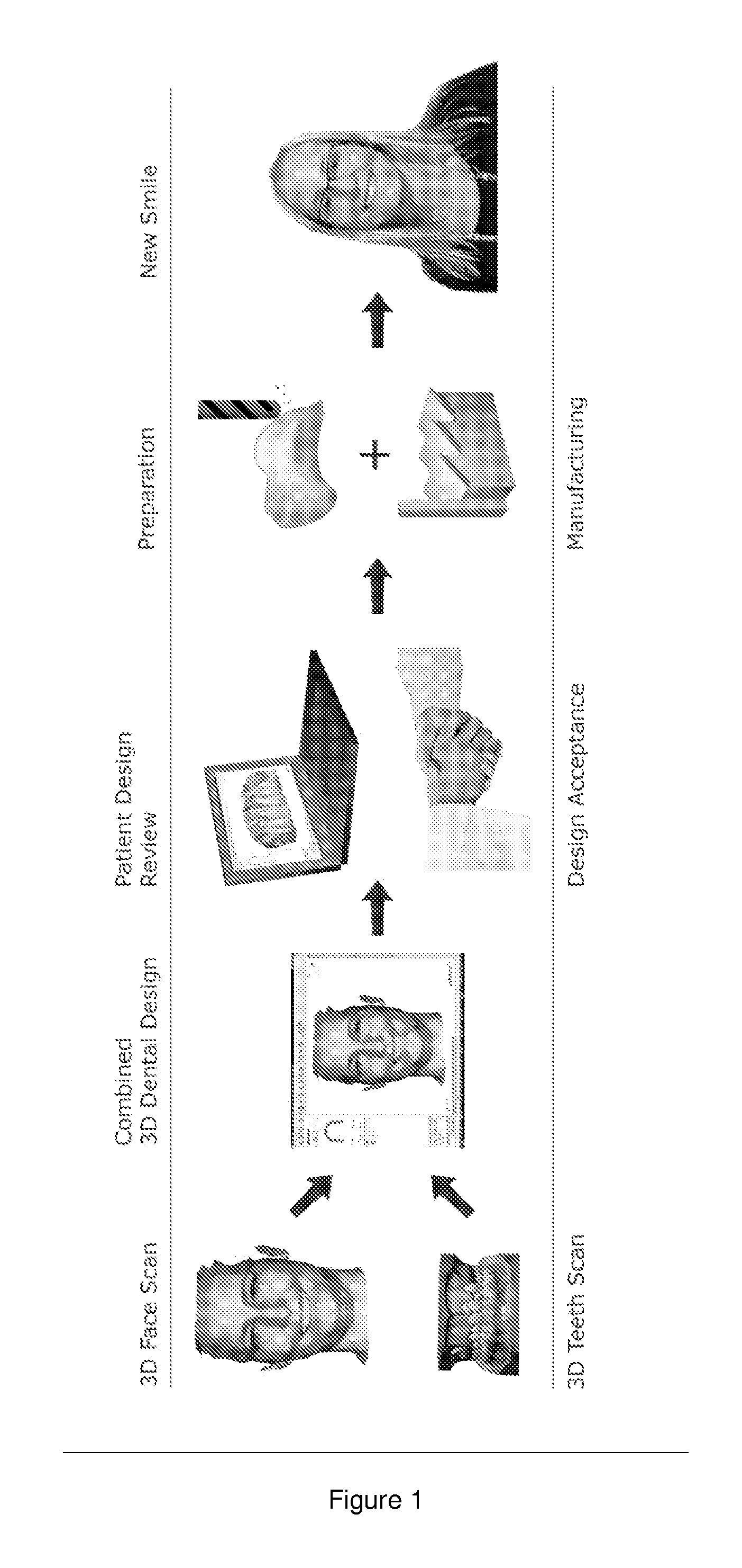System and method for effective planning, visualization, and optimization of dental restorations