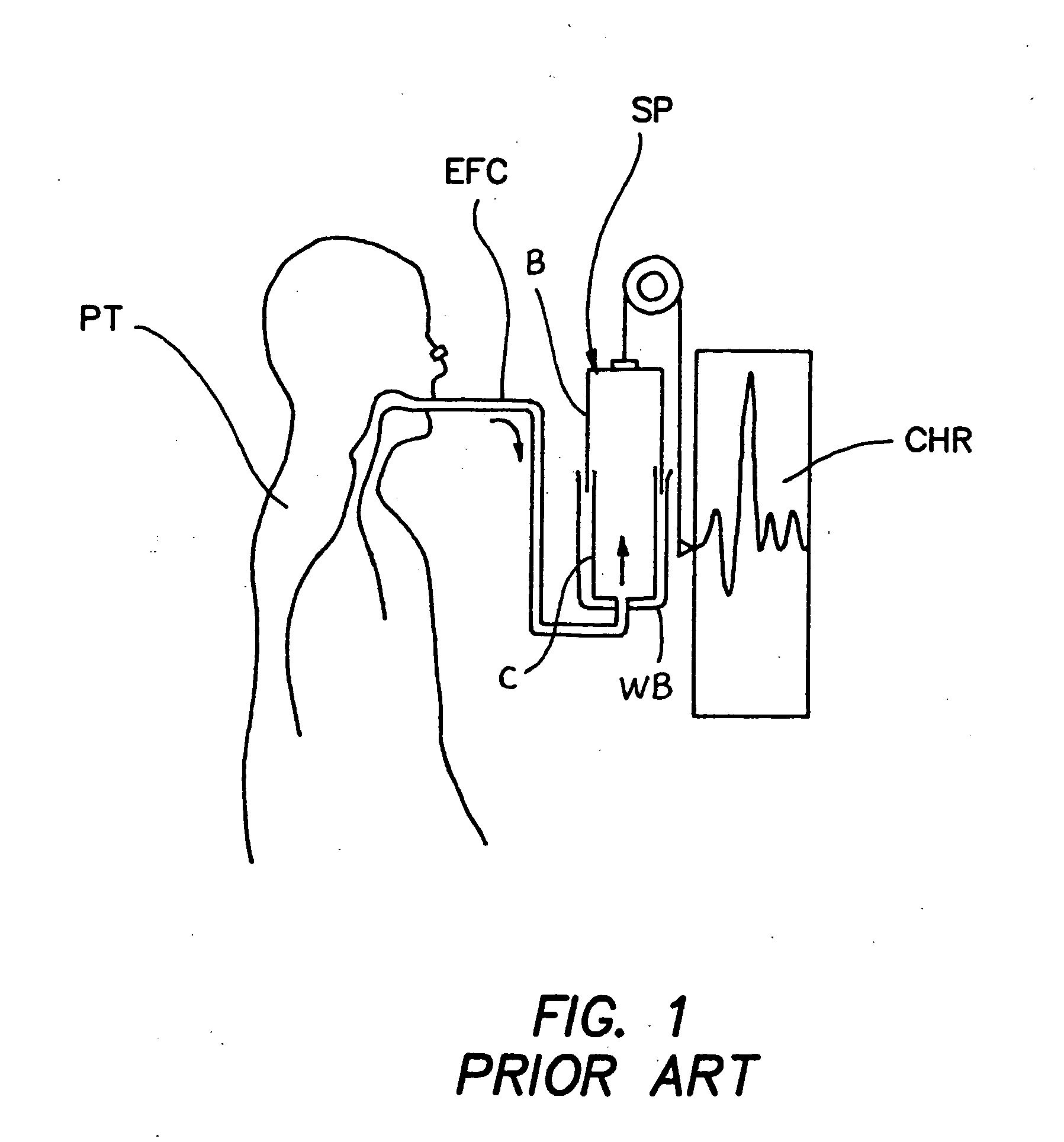 Stand-alone circle circuit with co2 absorption and sensitive spirometry for measurement of pulmonary uptake