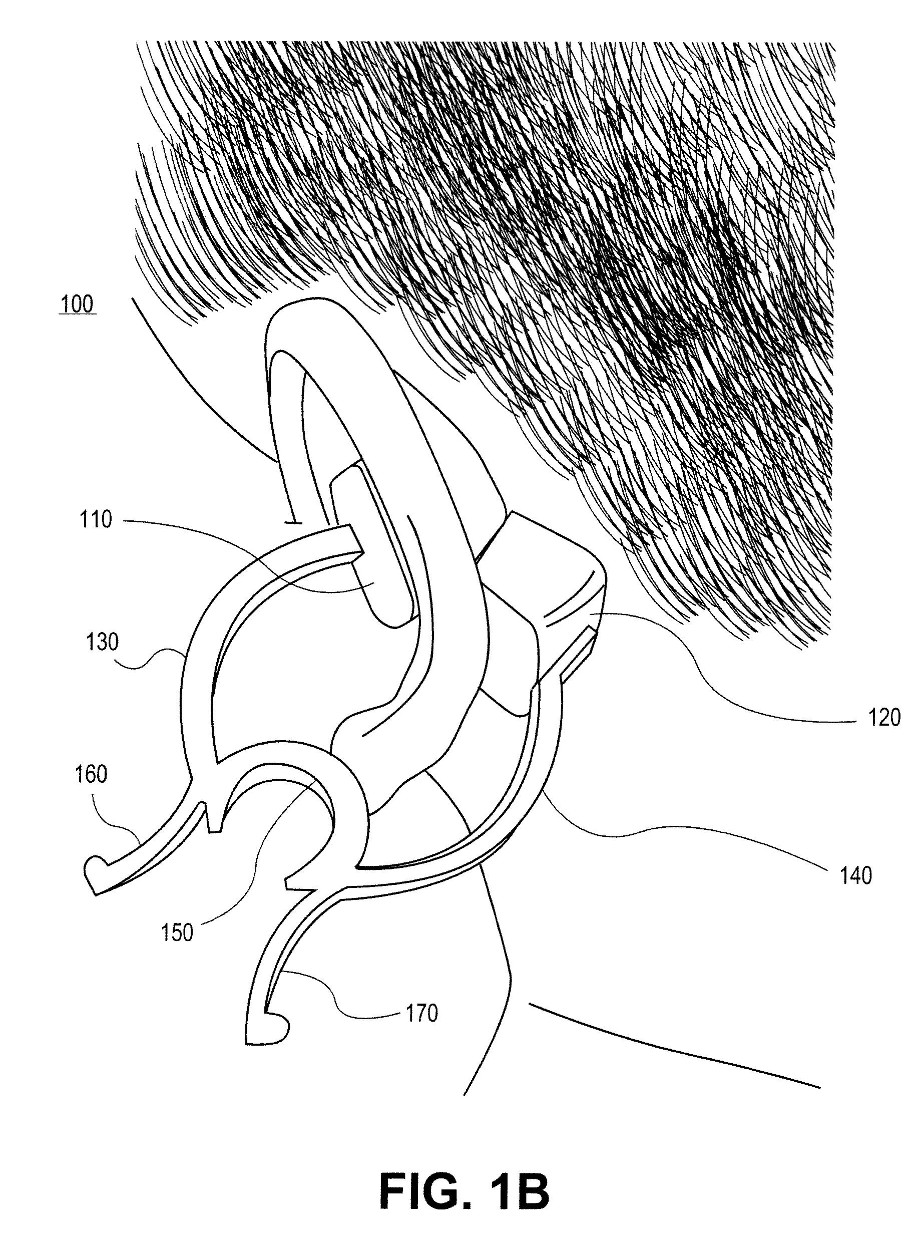 External ear-placed non-invasive physiological sensor