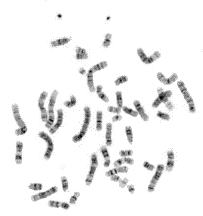 Marrow chromosome extraction kit