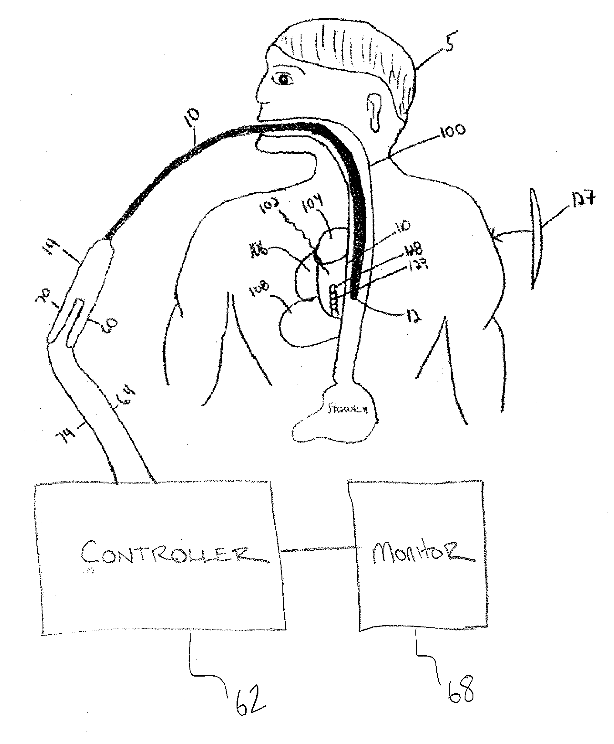 Medical probe and method of using same