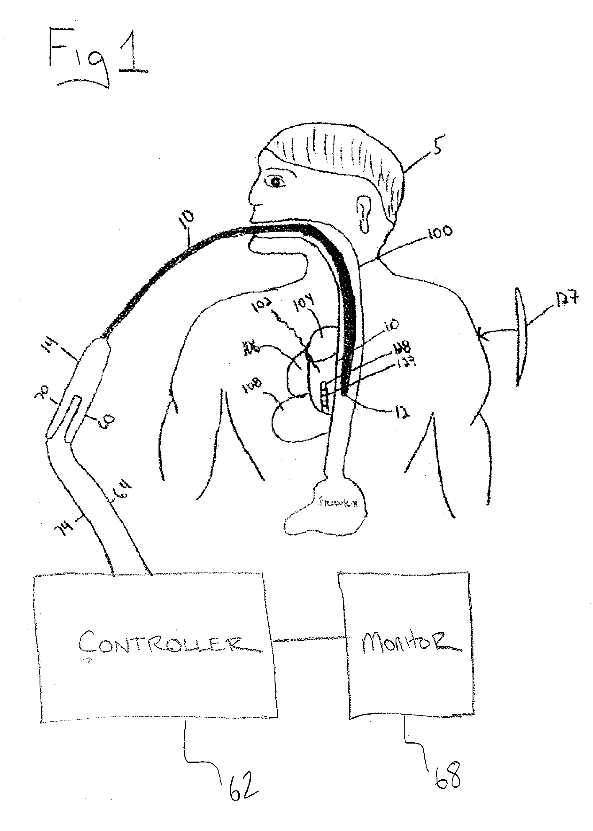 Medical probe and method of using same