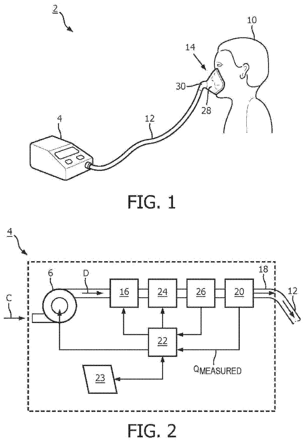 Systems and methods for concurrent airway stabilization and pulmonary stretch receptor activation