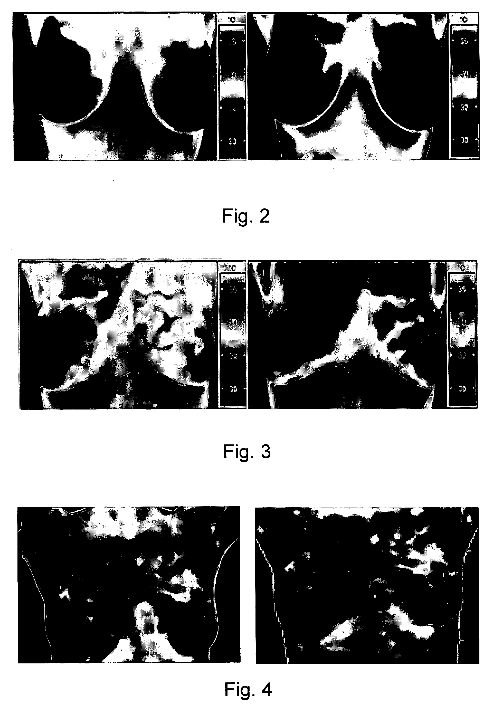 Infrared multi-spectral camera and process of using infrared multi-spectral camera