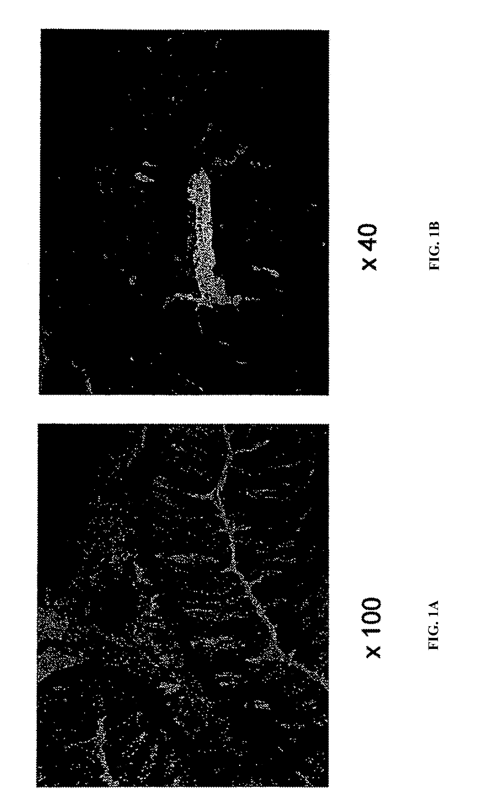 Muscle Derived Cells For The Treatment Of Gastro-Esophageal Pathologies And Methods Of Making And Using The Same