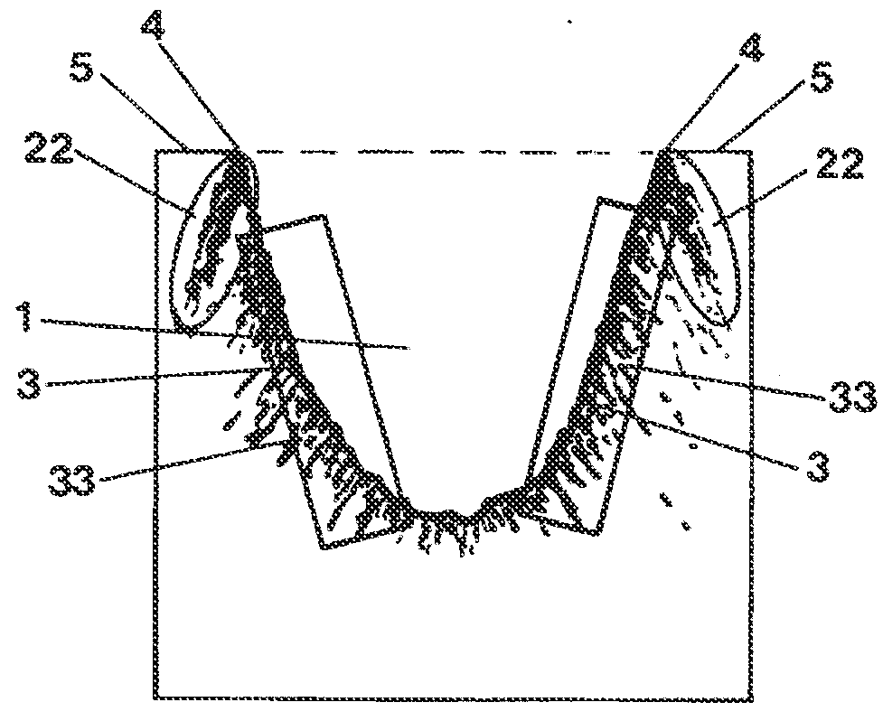 Method for removing brittle-hard material by means of laser radiation