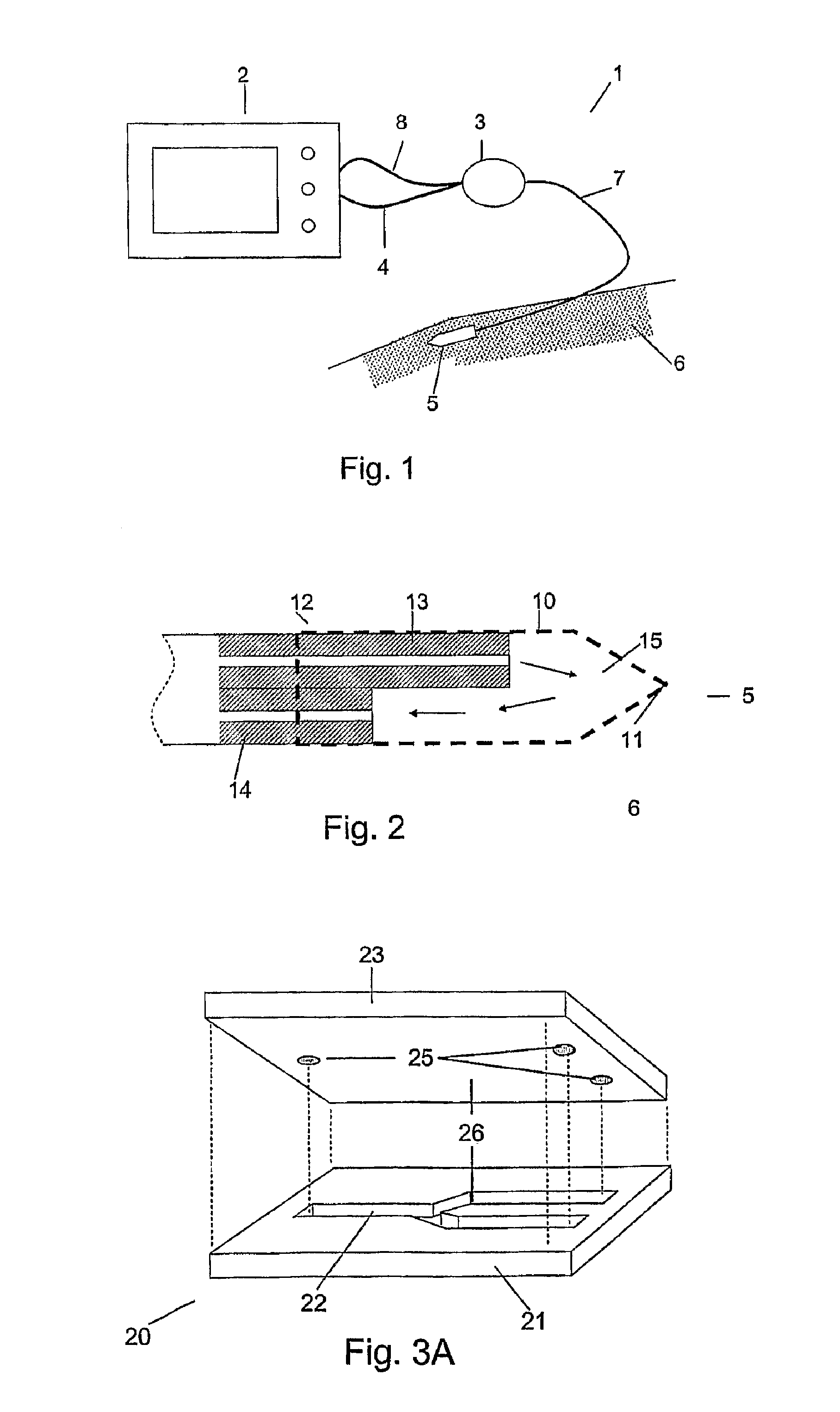 Analysis system with a remote analysing unit