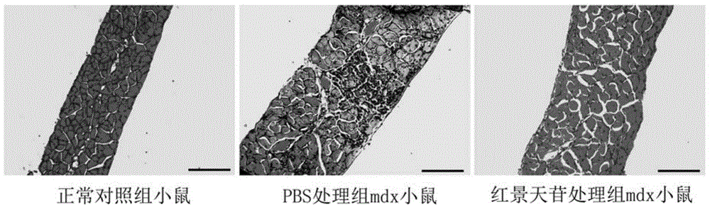 Application of salidroside in preparing medicine for treating duchenne muscular dystrophy