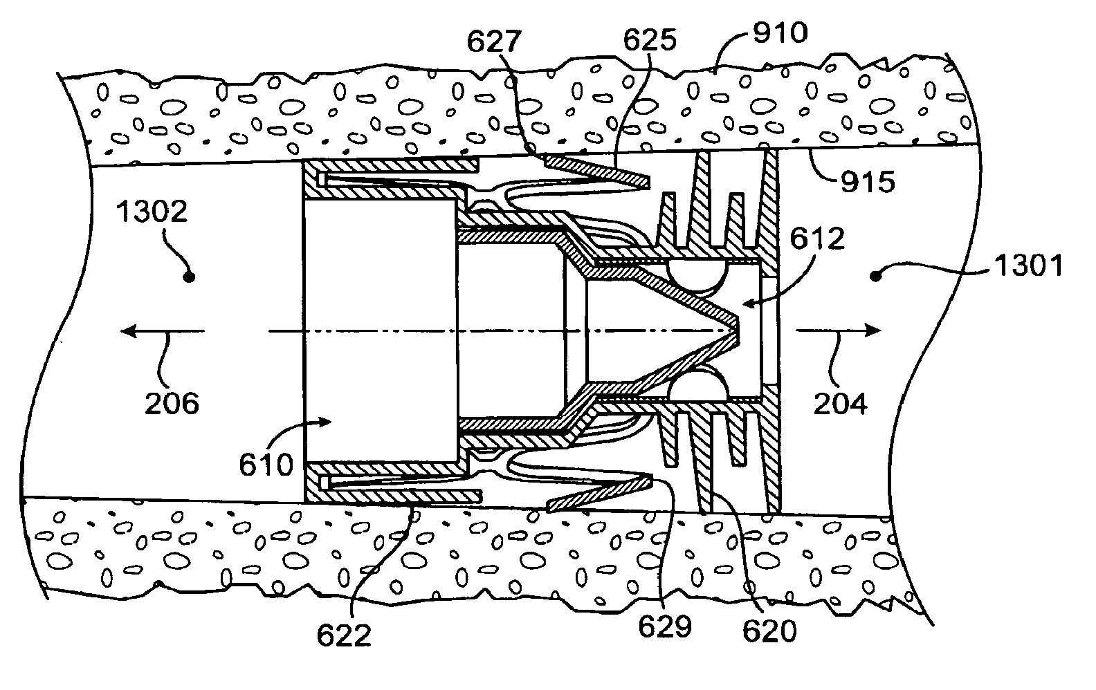 Bronchial flow control devices and methods of use