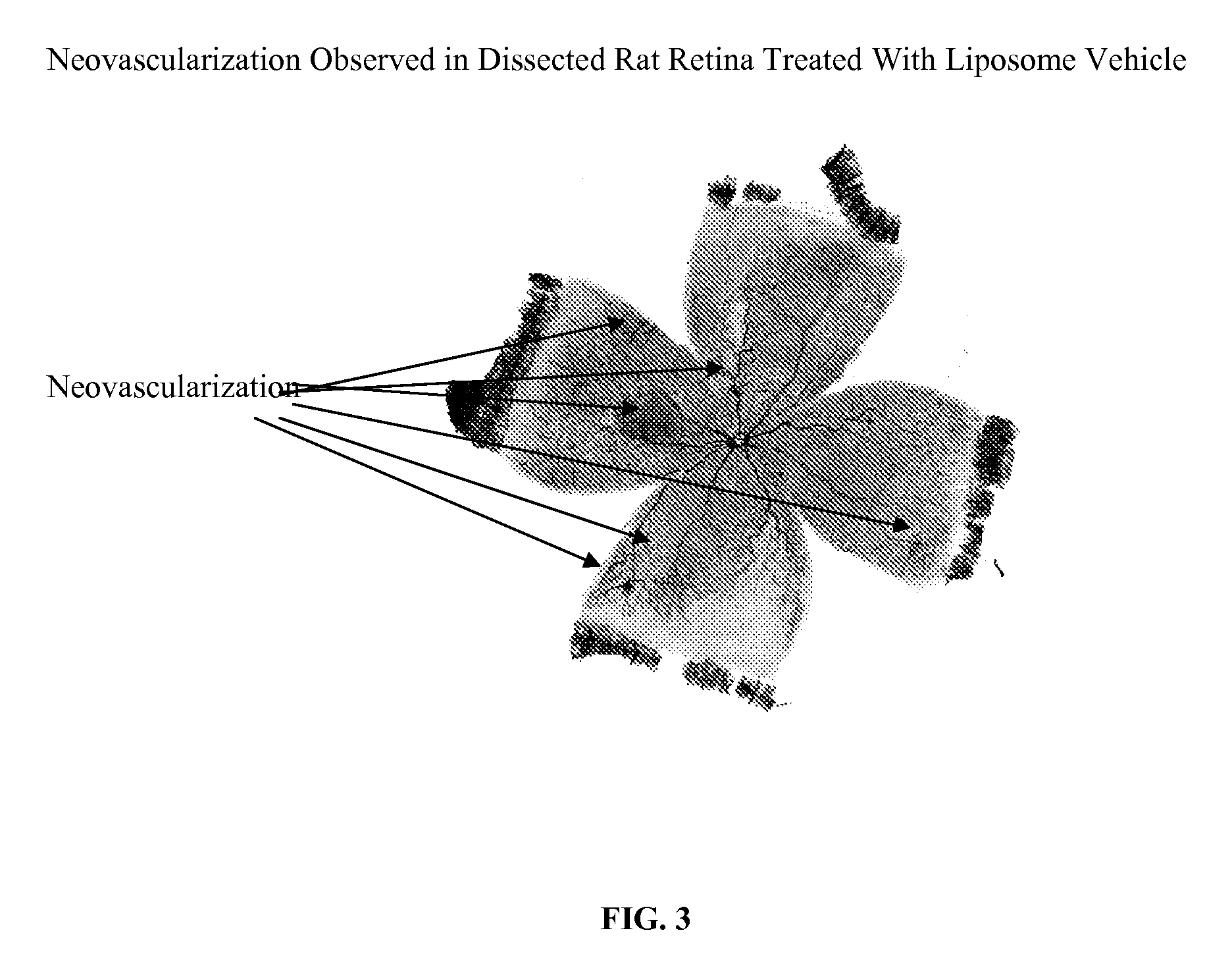 PHARMACEUTICAL FORMULATION FOR DELIVERY OF RECEPTOR TYROSINE KINASE INHIBITING (RTKi) COMPOUNDS TO THE EYE