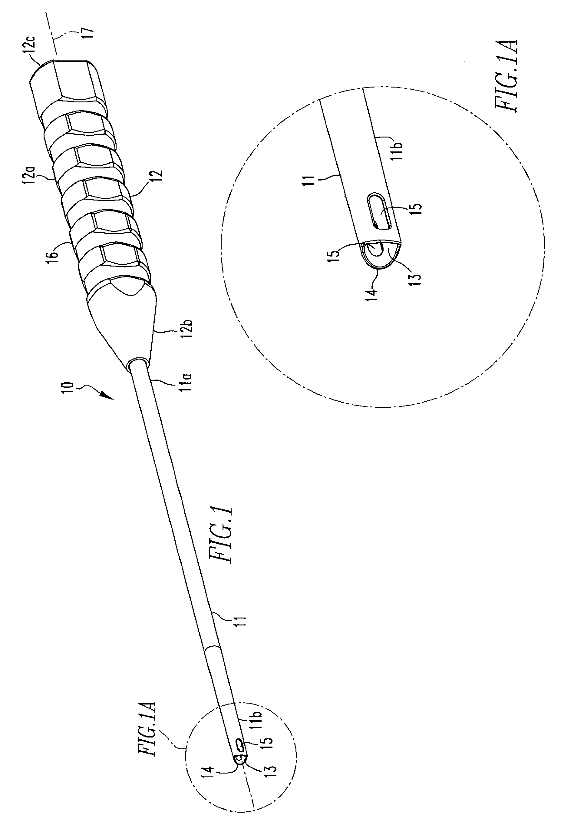 Anchor Delivery System