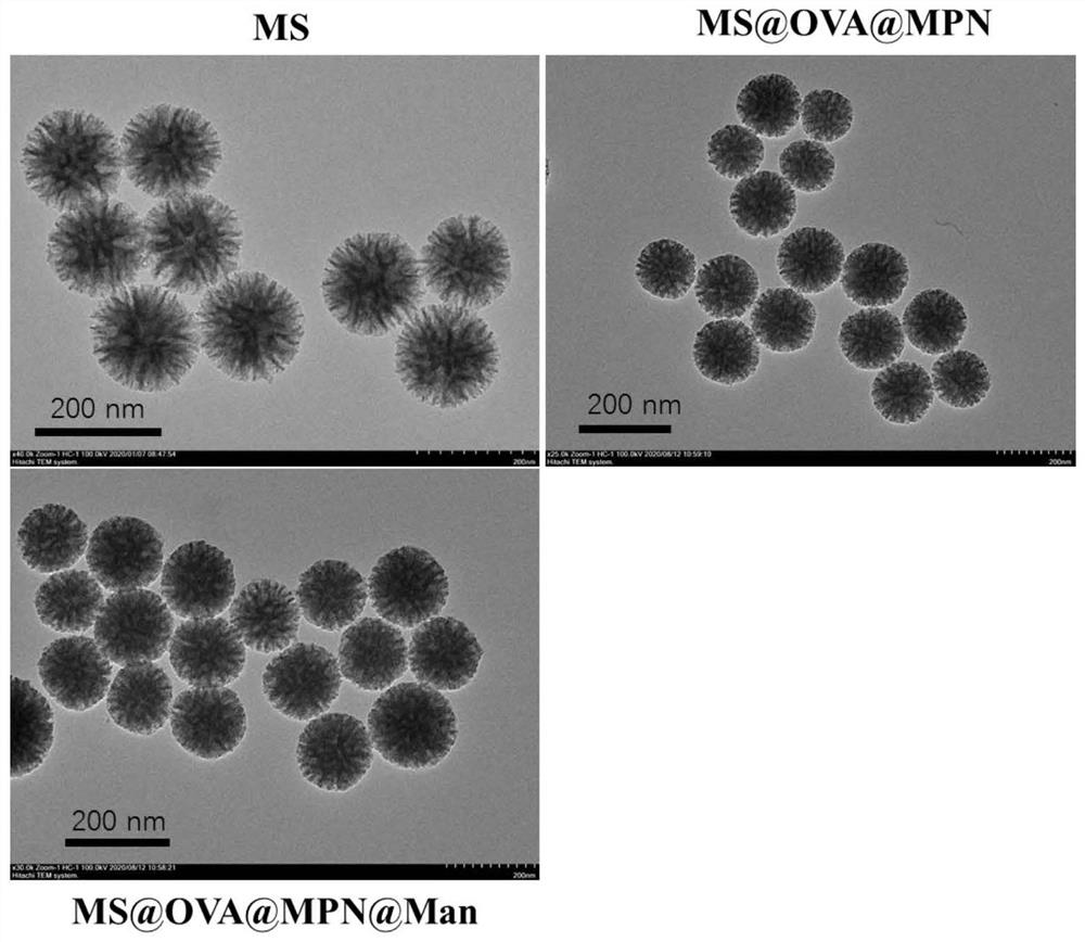 Targeted nano-vaccine preparation based on metal-polyphenol network structure and product of targeted nano-vaccine preparation