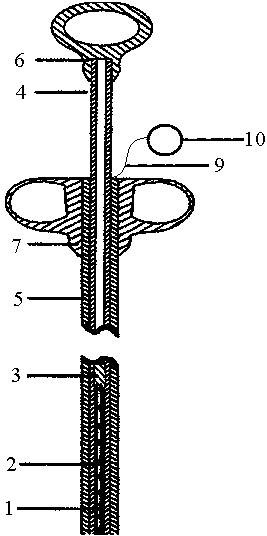 Excised tissue collector for laparoscopic operations