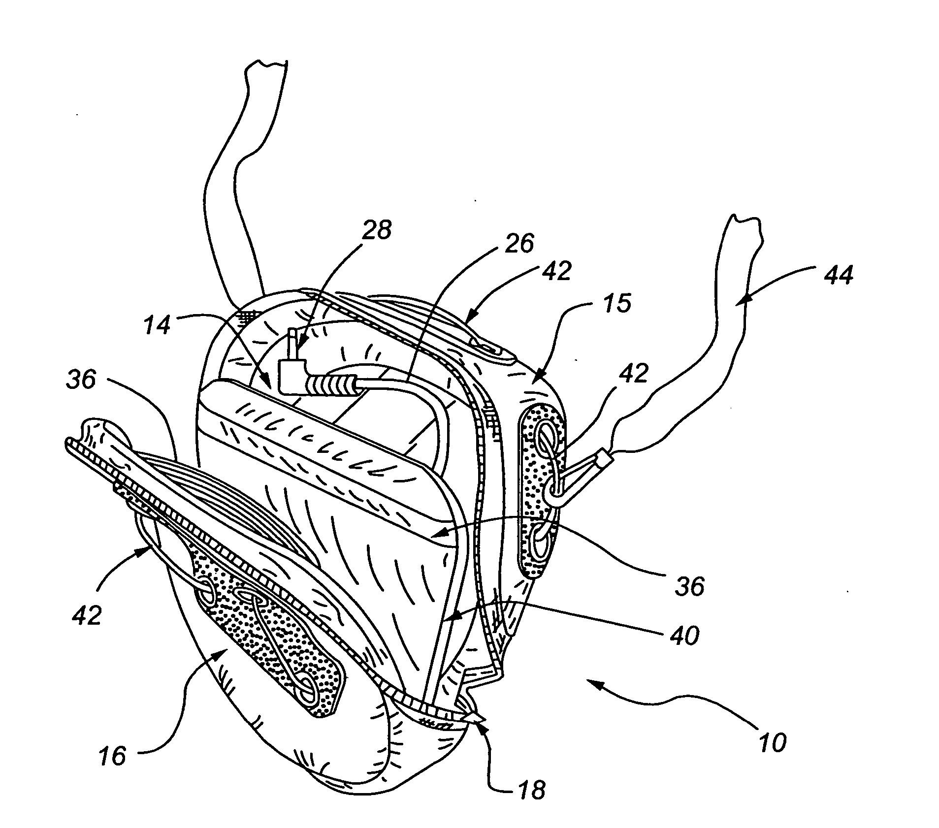 Protective enclosure with a line-out device adapted for use with electronic componentry