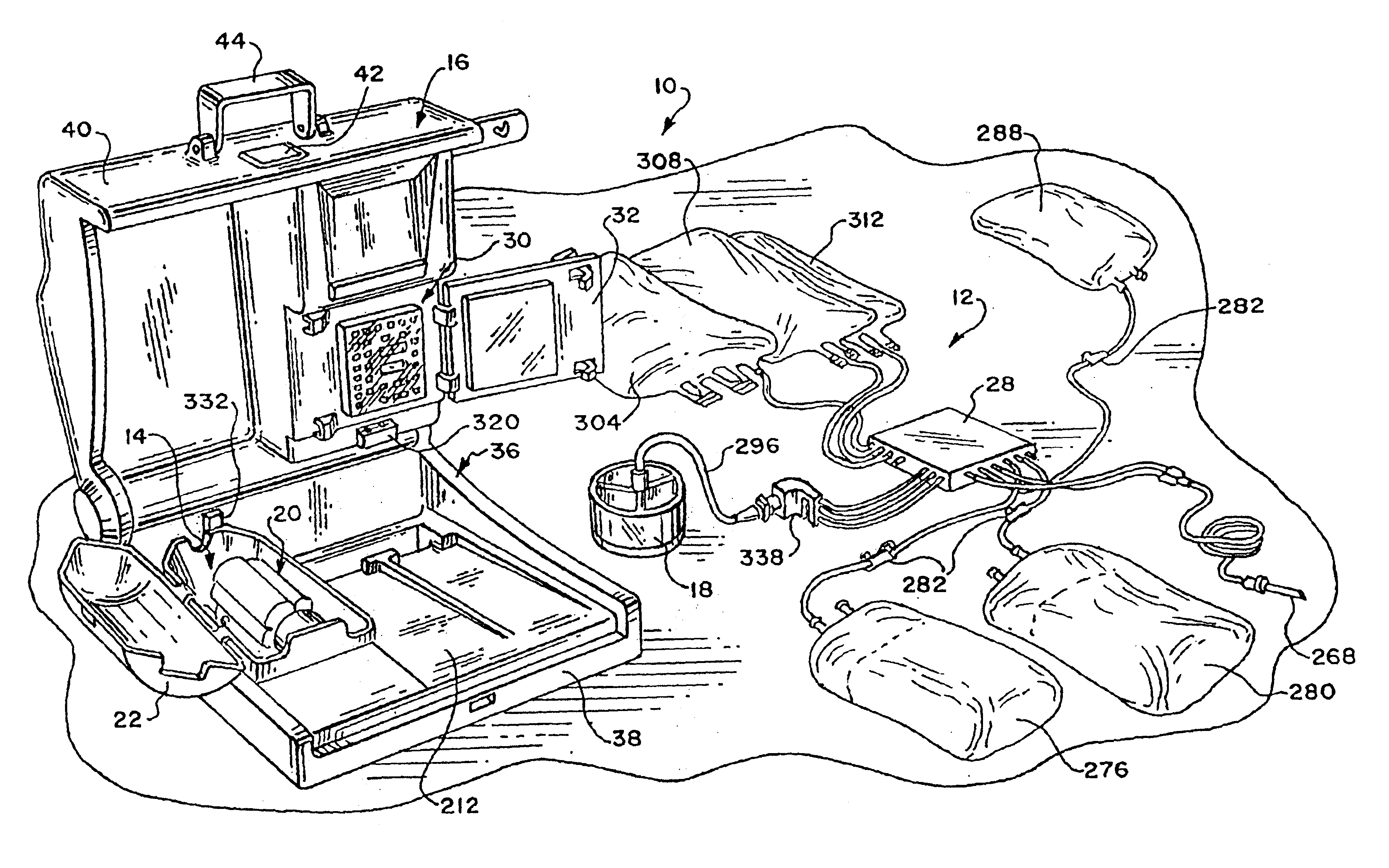 Systems and methods for control of pumps employing electrical field sensing