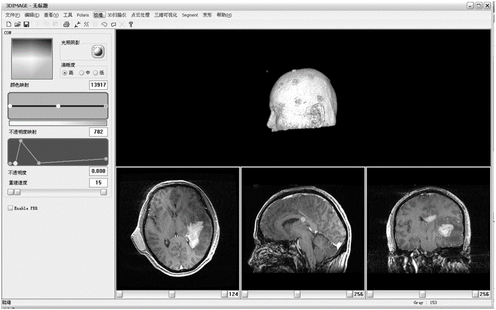Brain tissue deformation correction system based on wireless transmission