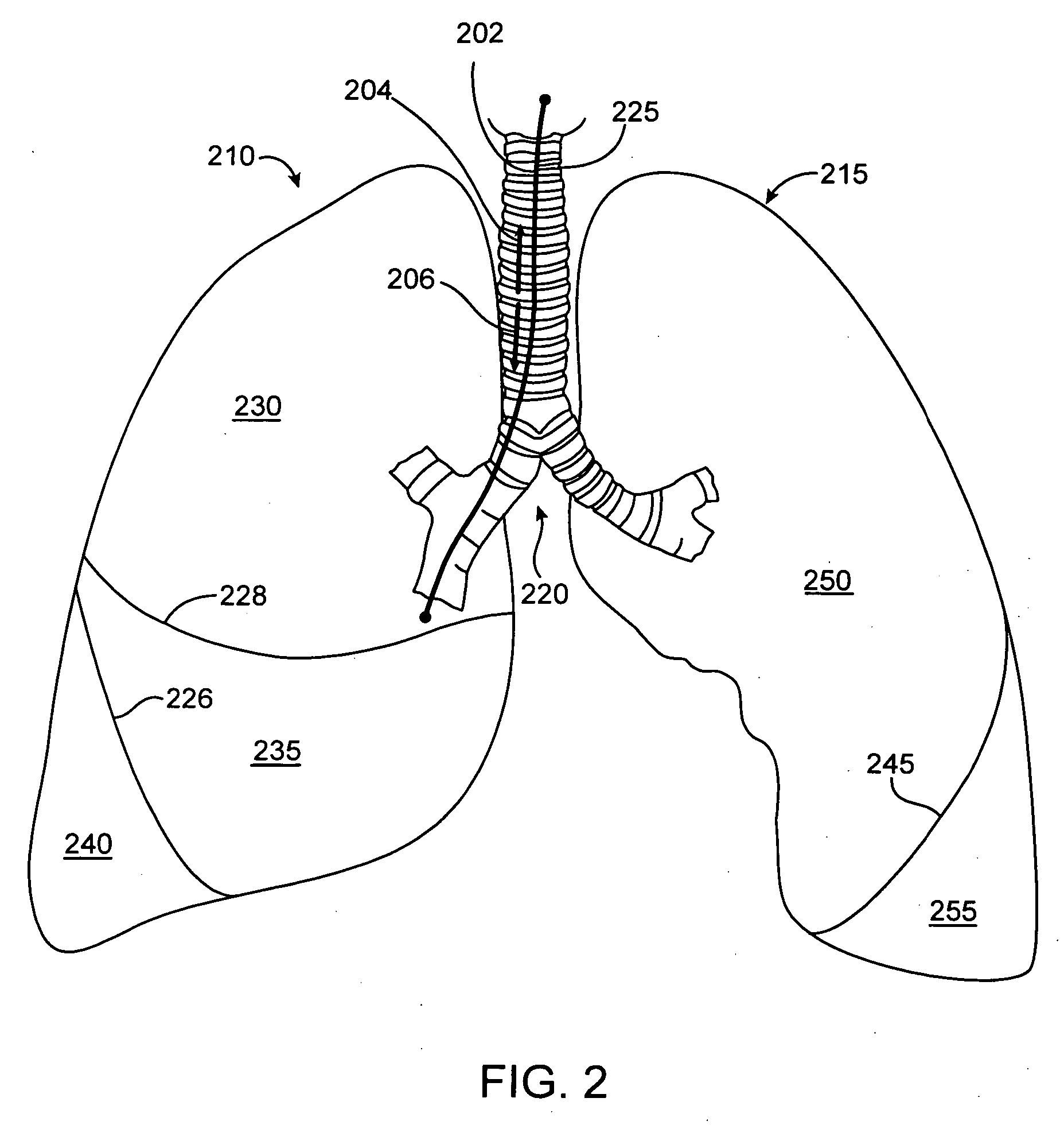 Delivery methods and devices for implantable bronchial isolation devices