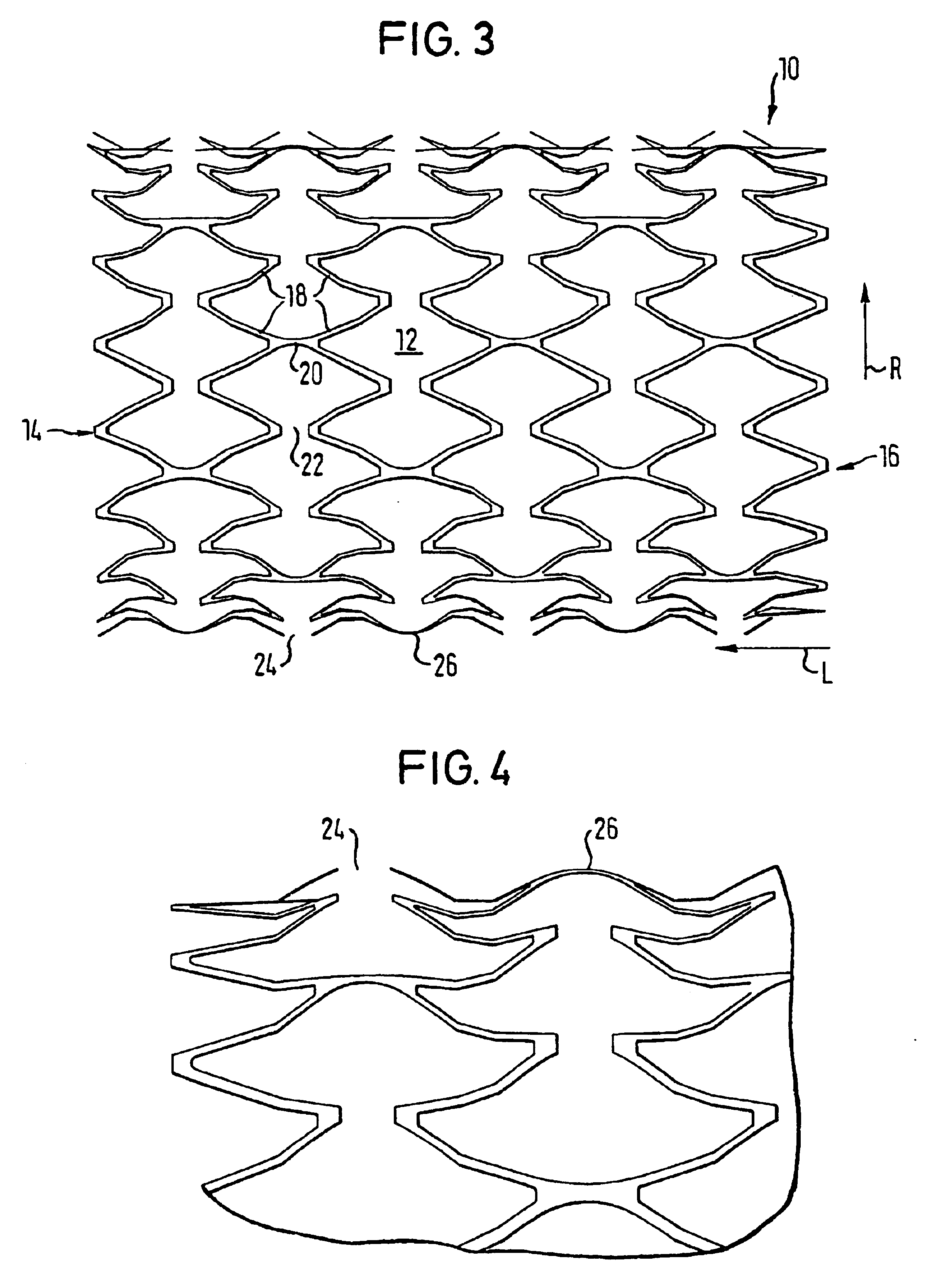 Expanded stent and a method for producing same