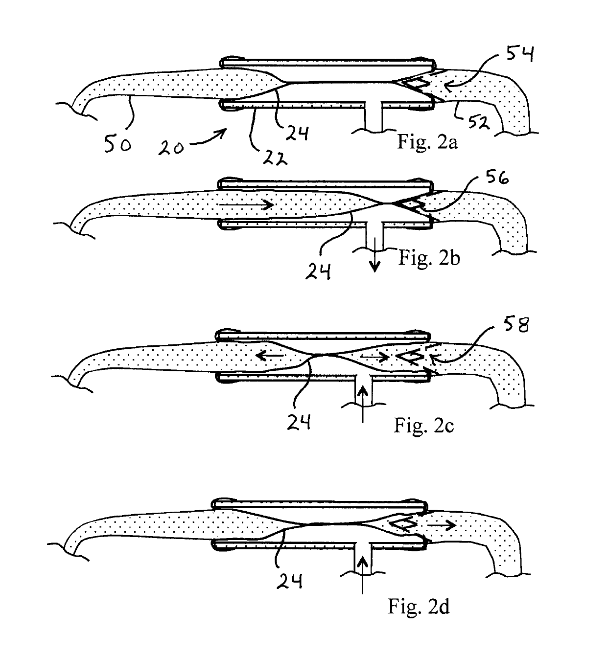 Afterload device for a beating heart during examination thereof