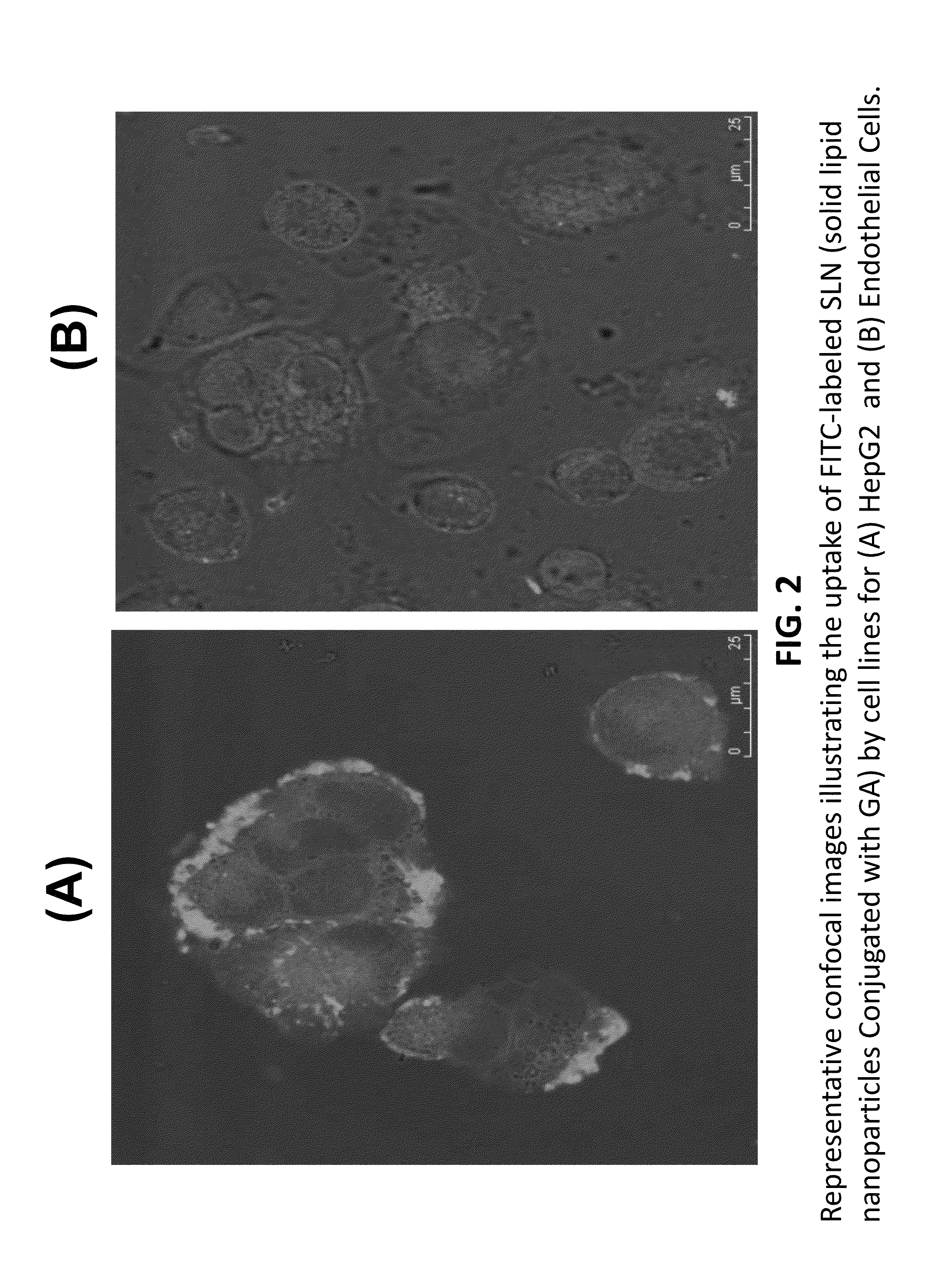 Nanoformulation and methods of use of thyroid receptor beta1 agonists for liver targeting