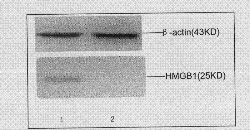 Plasmid for silencing cytokine signal inhibitory factor 1 and expressing high mobility group B1 protein and tumor associated antigen and preparation method thereof