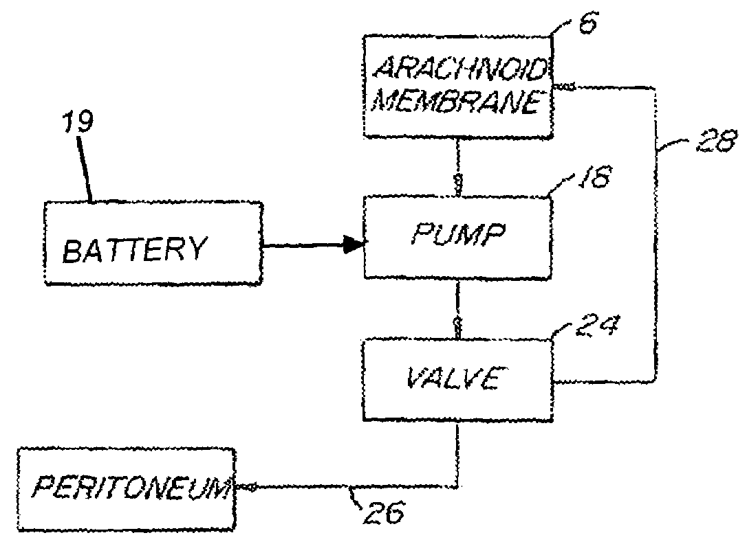 Internally powered CSF pump systems and methods