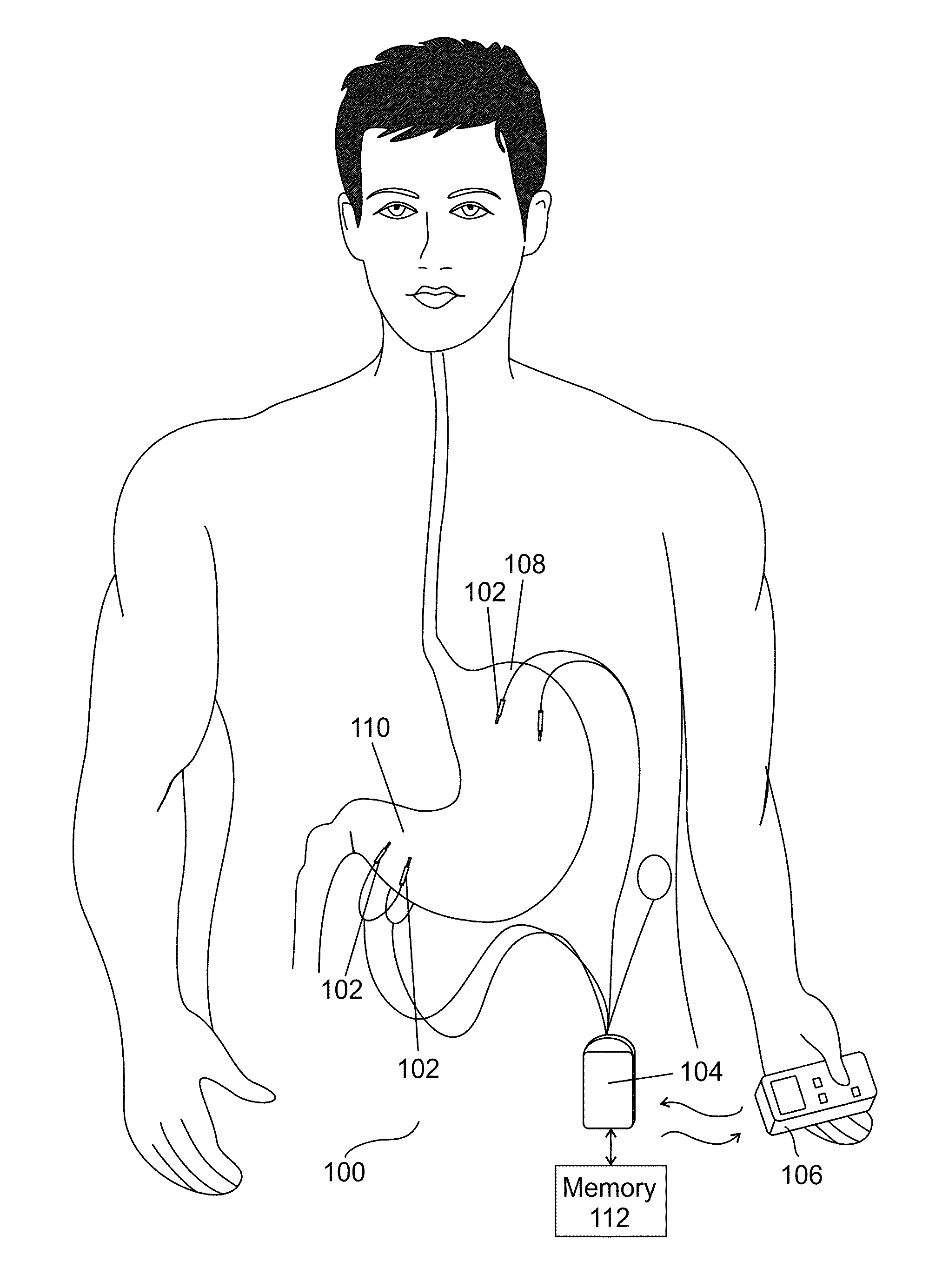 Method of treating a patient