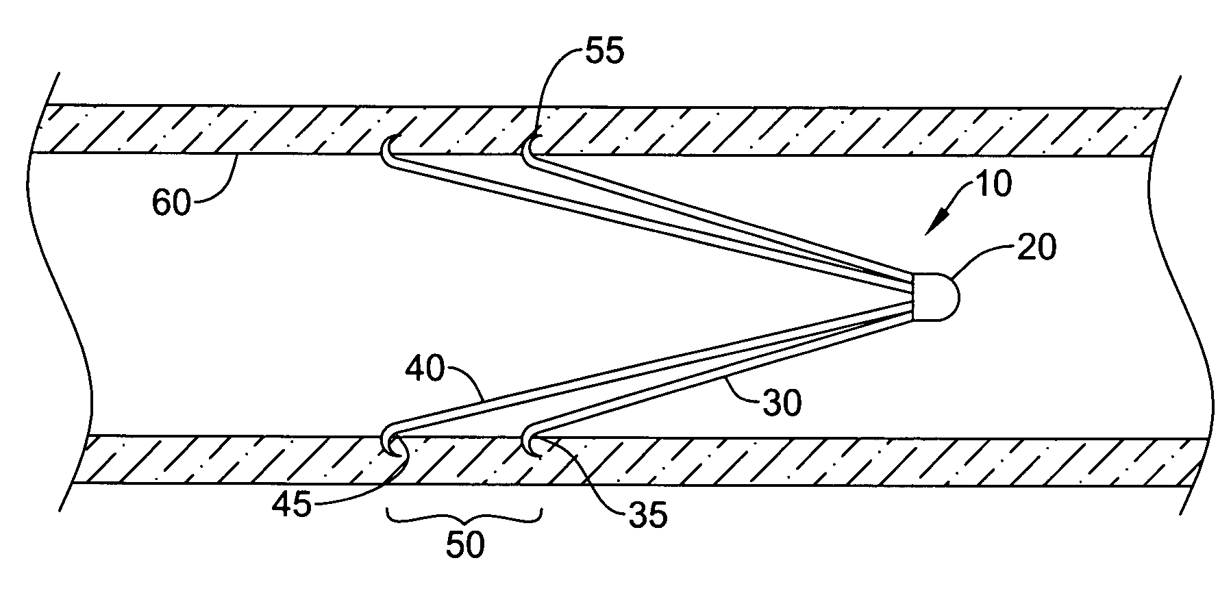 Filter with positioning and retrieval devices and methods