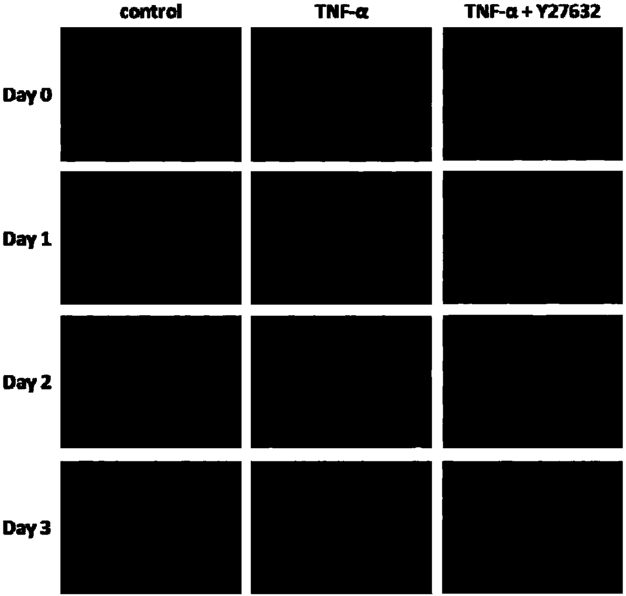 Establishment method and applications of microfluidic-chip-based tumor infiltration model