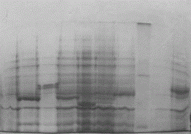 A Universal Polyacrylamide Gel Protein Rapid Separation and Staining Kit