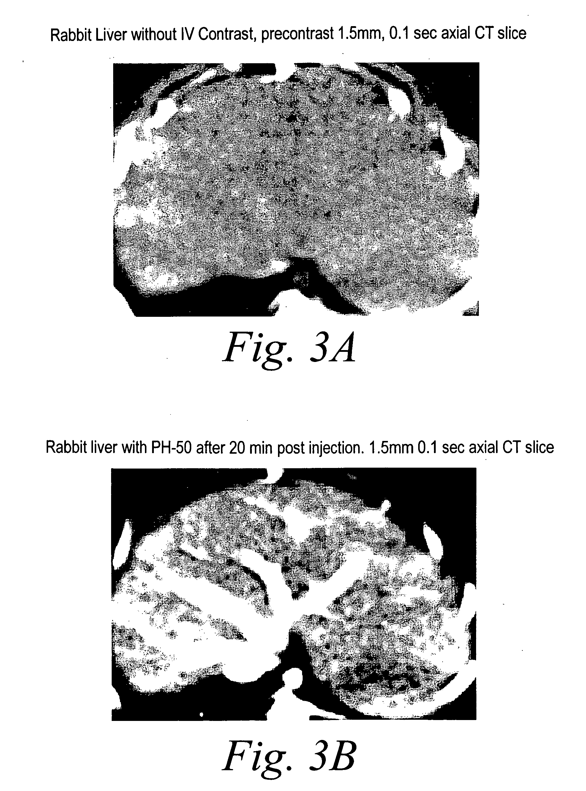 Compositions and methods for delivering pharmaceutically active agents using nanoparticulates