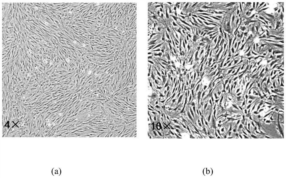 Mesenchymal stem cell drug for immune function regulation and preparation method thereof