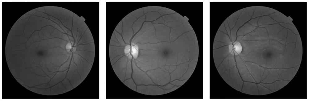 Fundus optic disc and fovea centralis real-time detection device and method based on deep learning