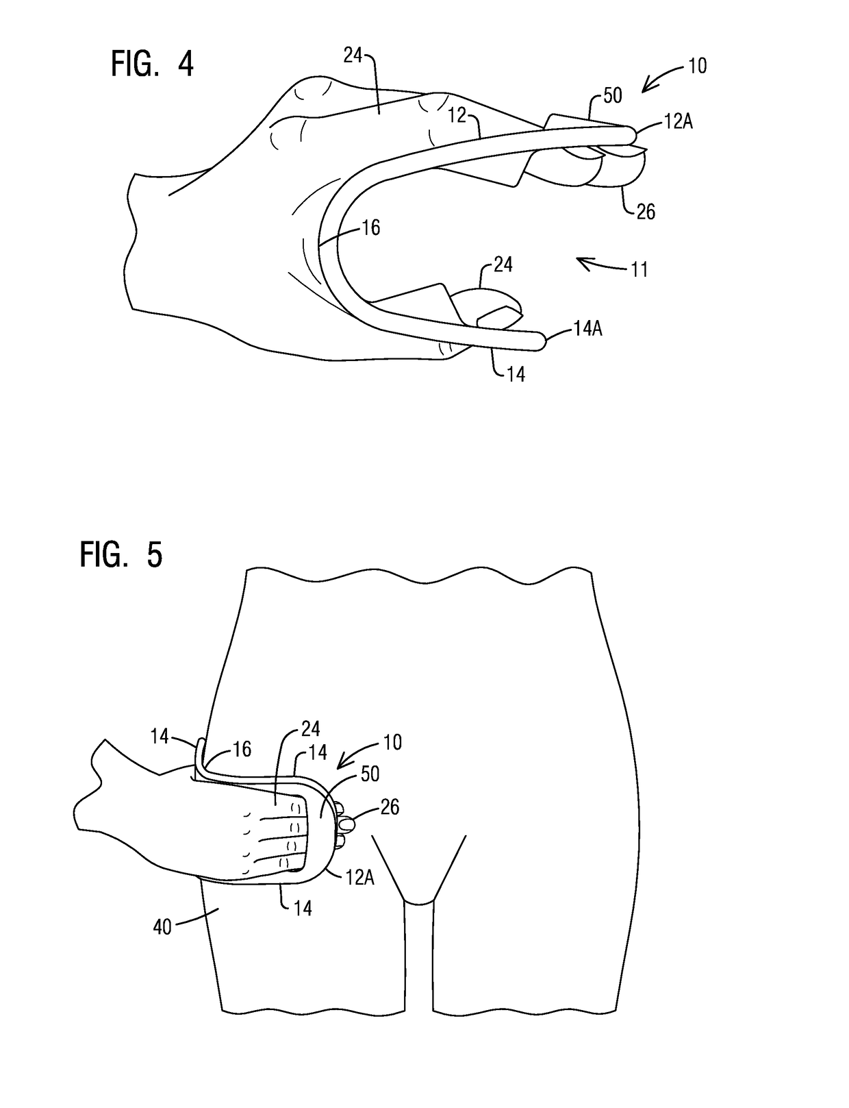 Vascular compression assist device and method of tactile hemostasis