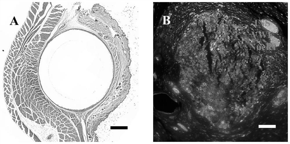 A neovascular construct for implanting into the subcutaneous tissue of a subject and its preparation method