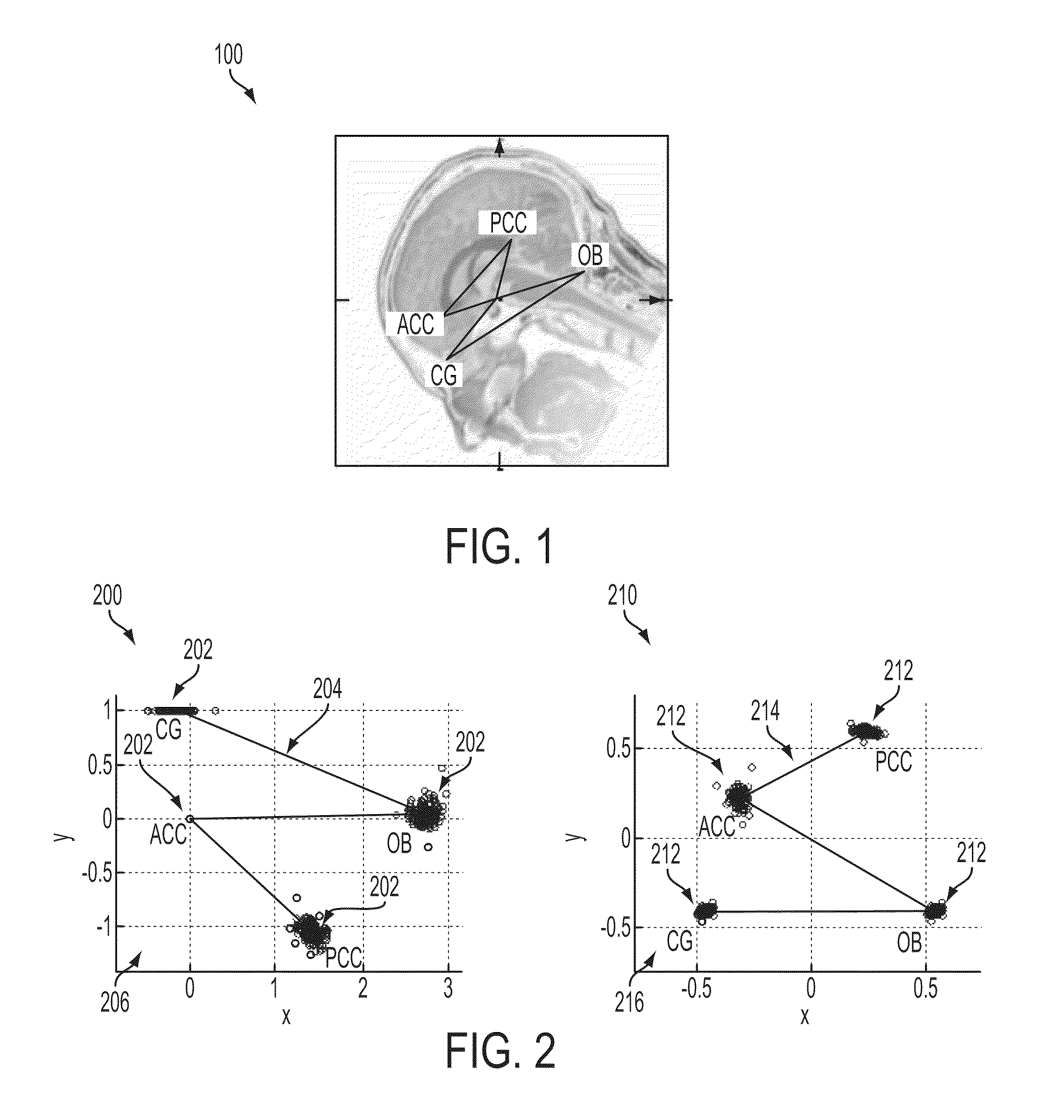 Method and System for Anatomic Landmark Detection Using Constrained Marginal Space Learning and Geometric Inference