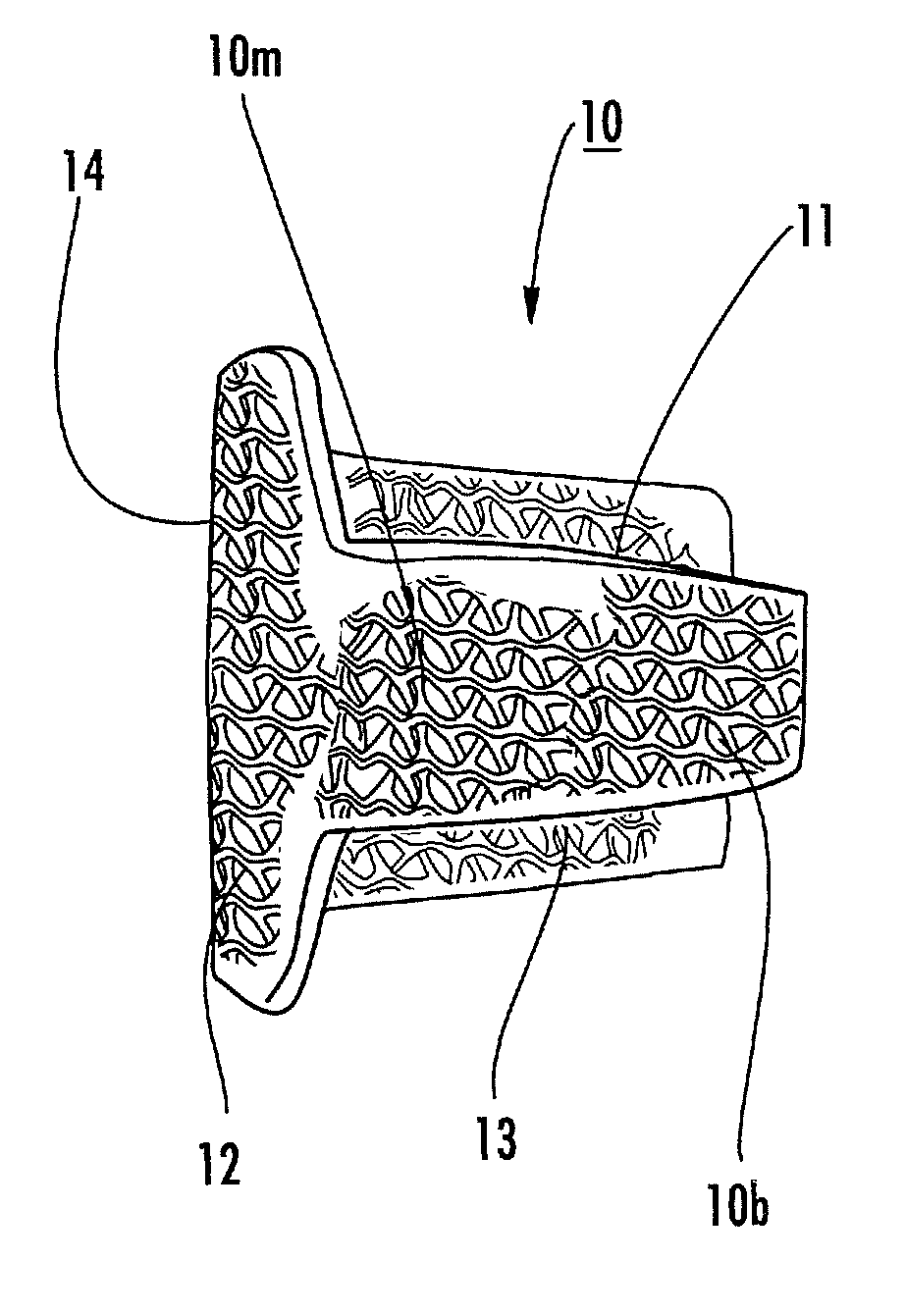 Methods and systems for forming implants with selectively exposed mesh for fixation and related implants