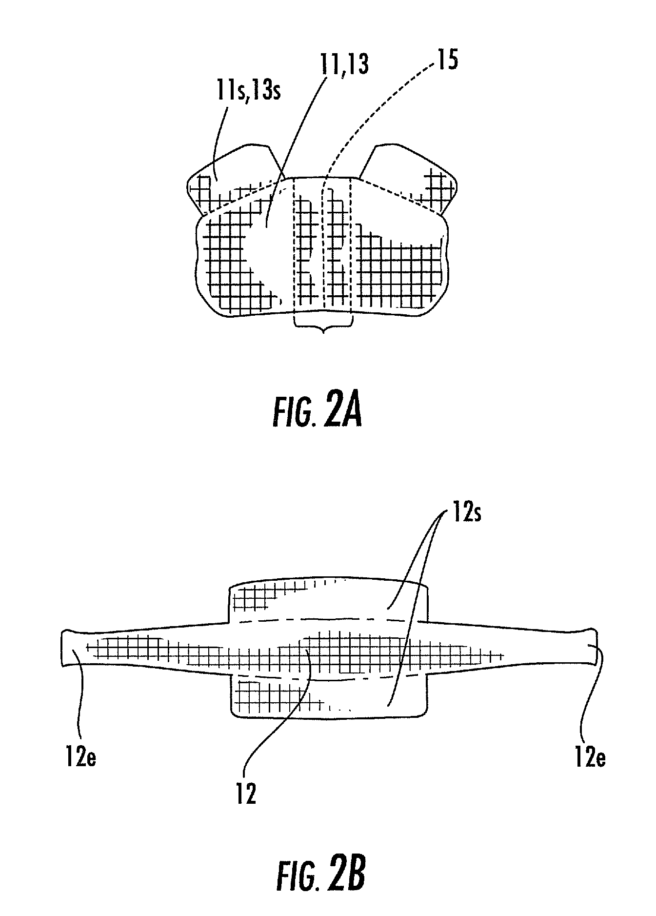 Methods and systems for forming implants with selectively exposed mesh for fixation and related implants