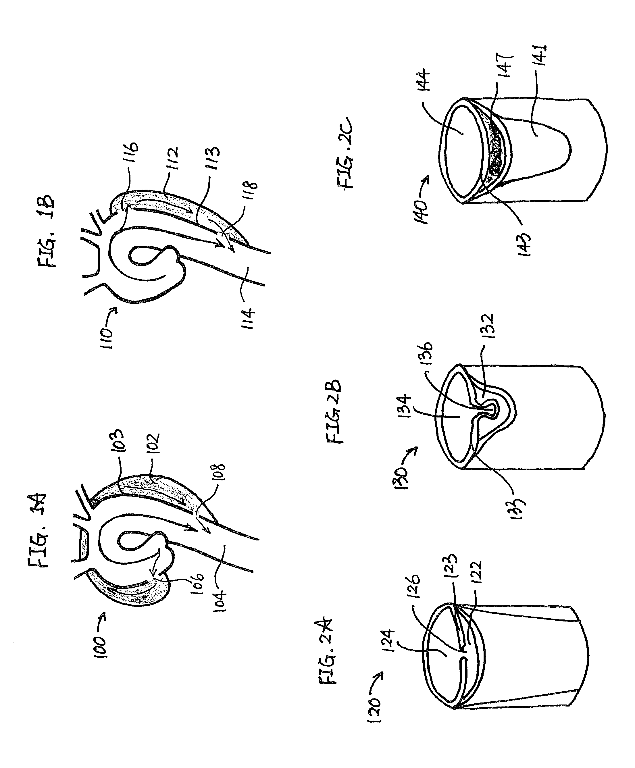 Devices, therapeutic compositions and corresponding percutaneous treatment methods for aortic dissection