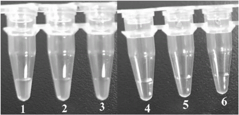 LAMP (loop-mediated isothermal amplification) primer composition for detecting Candida krusei, LAMP detection kit based on LAMP primer composition, and application method of LAMP detection kit