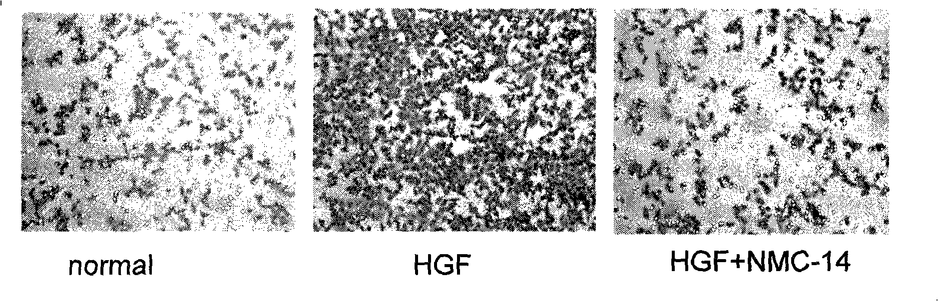 HGF/c-Met signalling channel restrainer, preparation method and application thereof