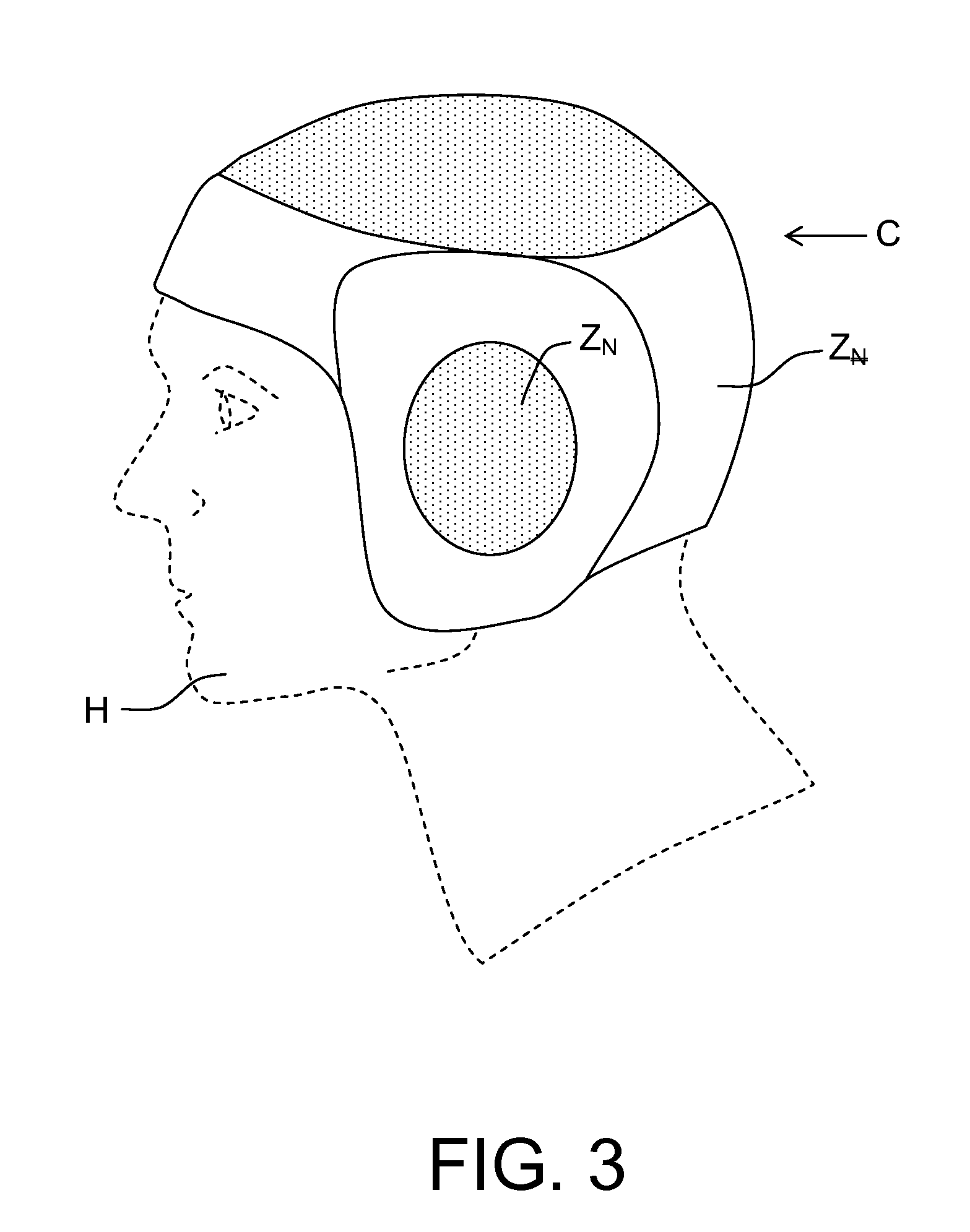Helmet Shell Made of Composite Material