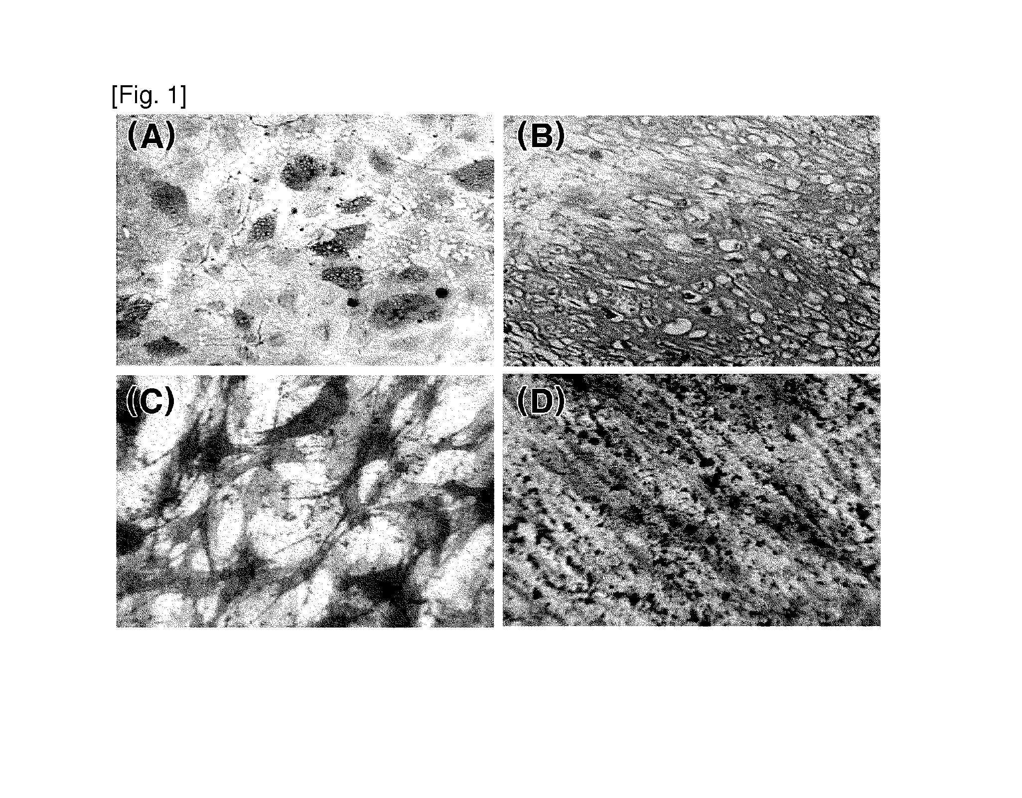 Adult stem cell line introduced with hepatocyte growth factor gene and neurogenic transcription factor gene with basic helix-loop-helix motif and uses thereof